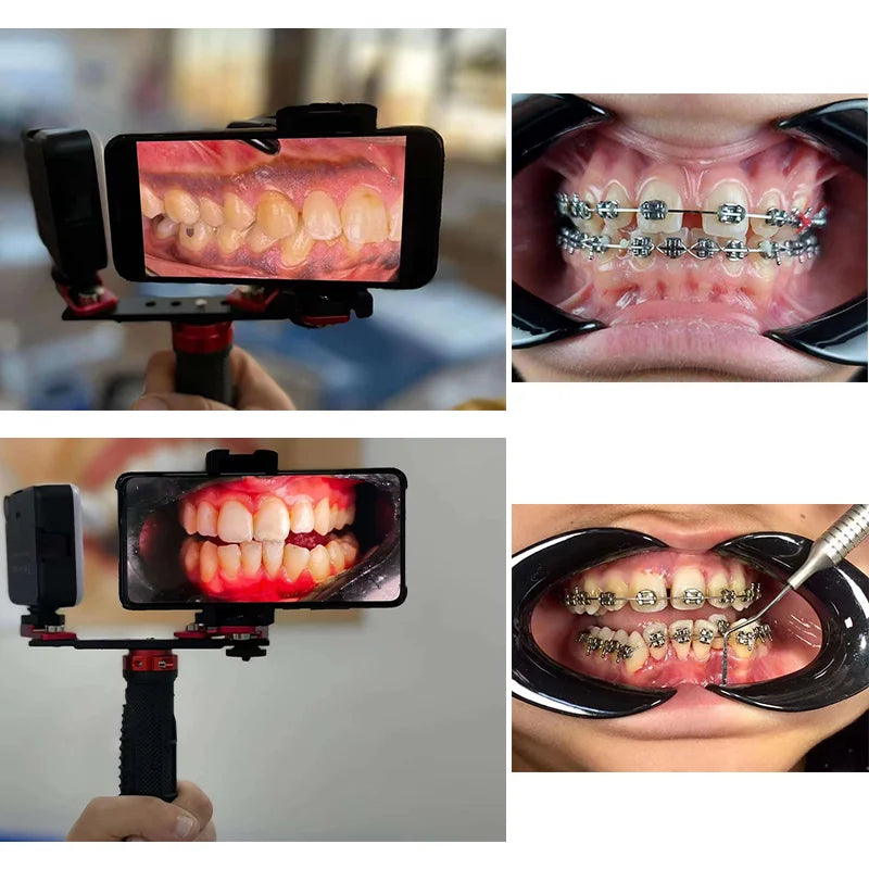 Portable Intraoral Filling Lamp Oral Lighting Brightness Adjustment Equipment Dental Fill Light LED Flash Mobile Photography